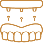 dental-implant