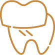dental-veneer